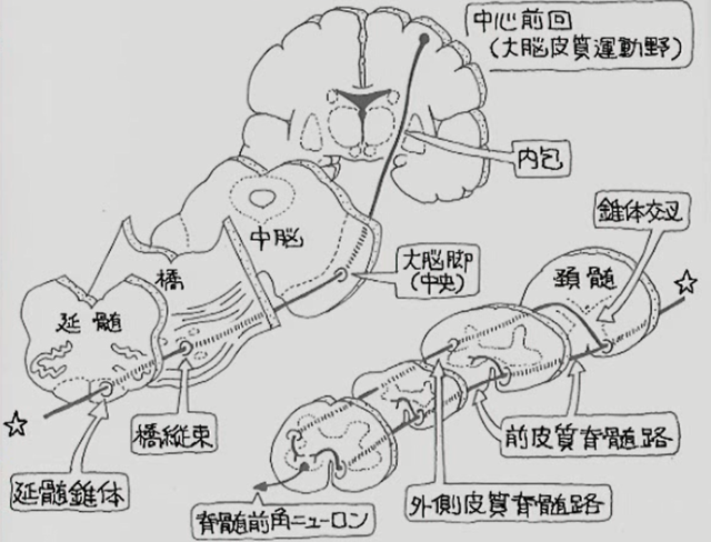 頸椎ヘルニアの病的反射