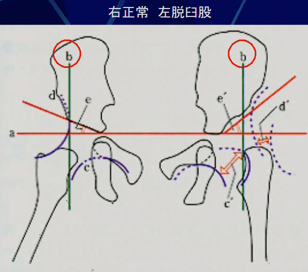 オンブレダンヌ線