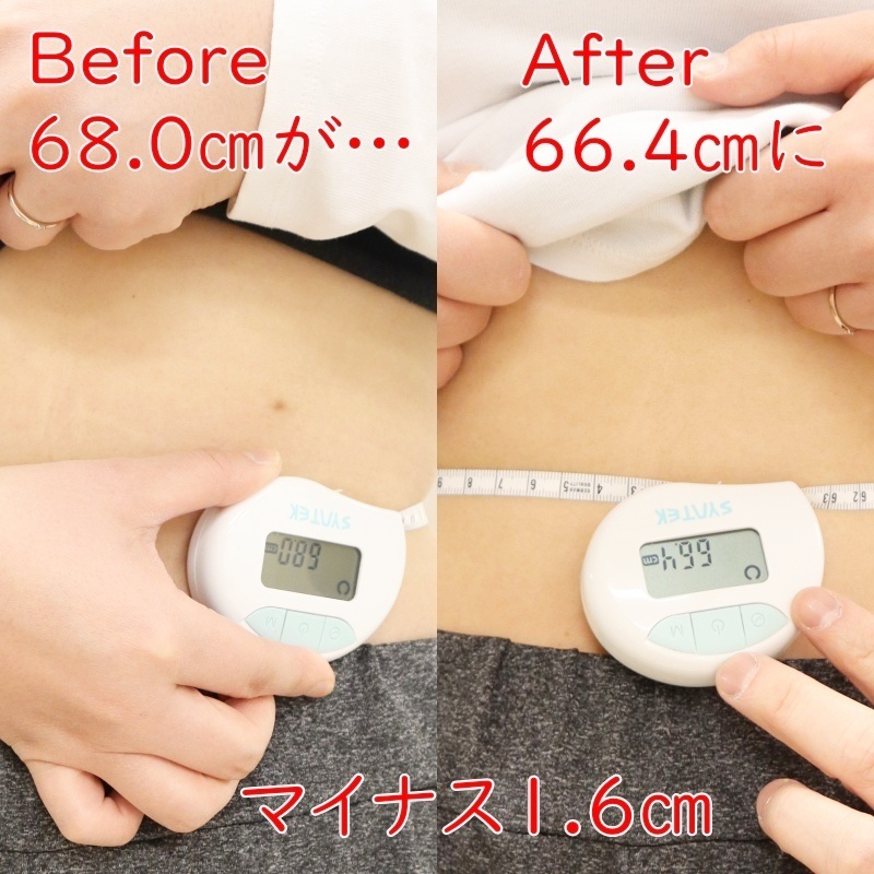 仙骨矯正ビフォーアフター品川区