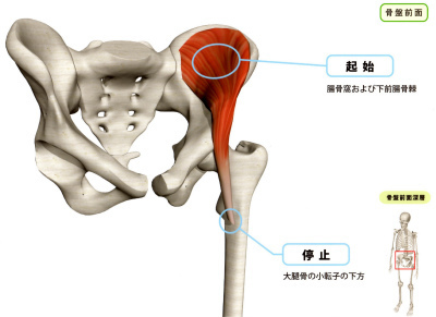 腰痛の原因の筋肉　腸骨筋