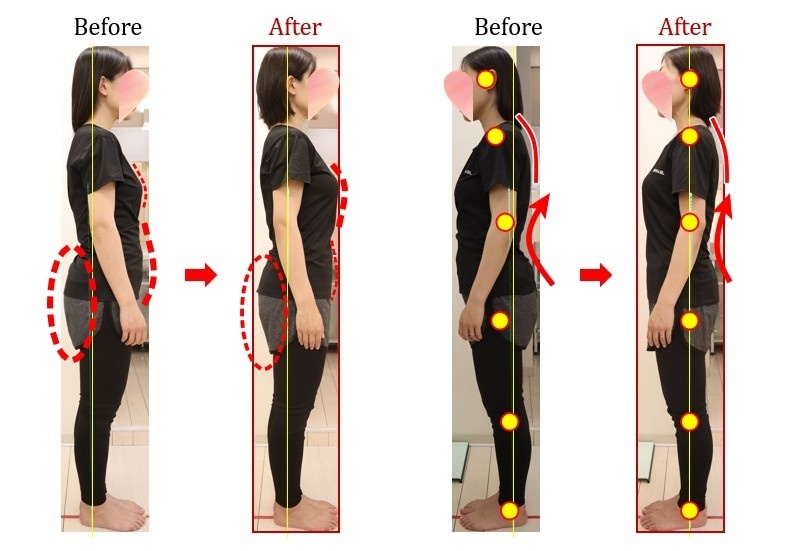 Before After 美容整体