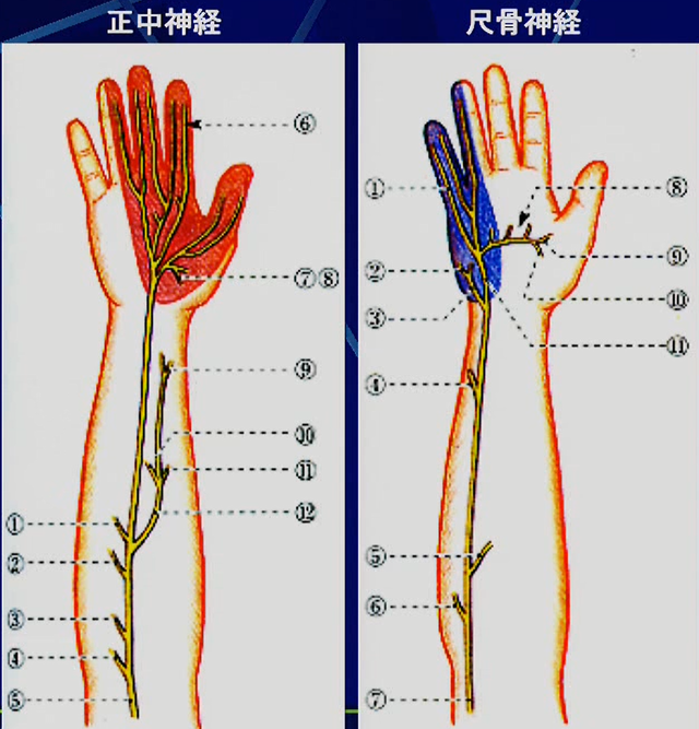 手の神経学