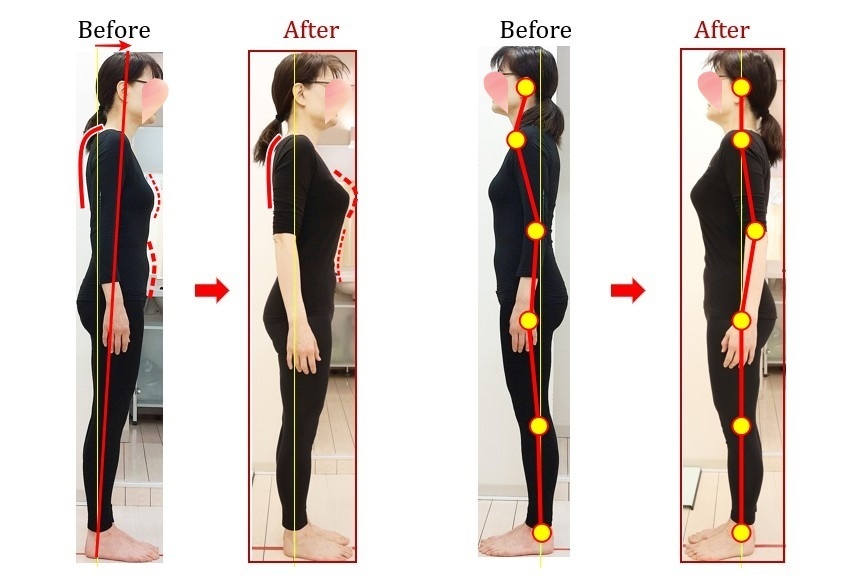 Before After 美容整体