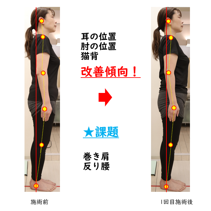 美容整体前後のビフォーアフター品川区