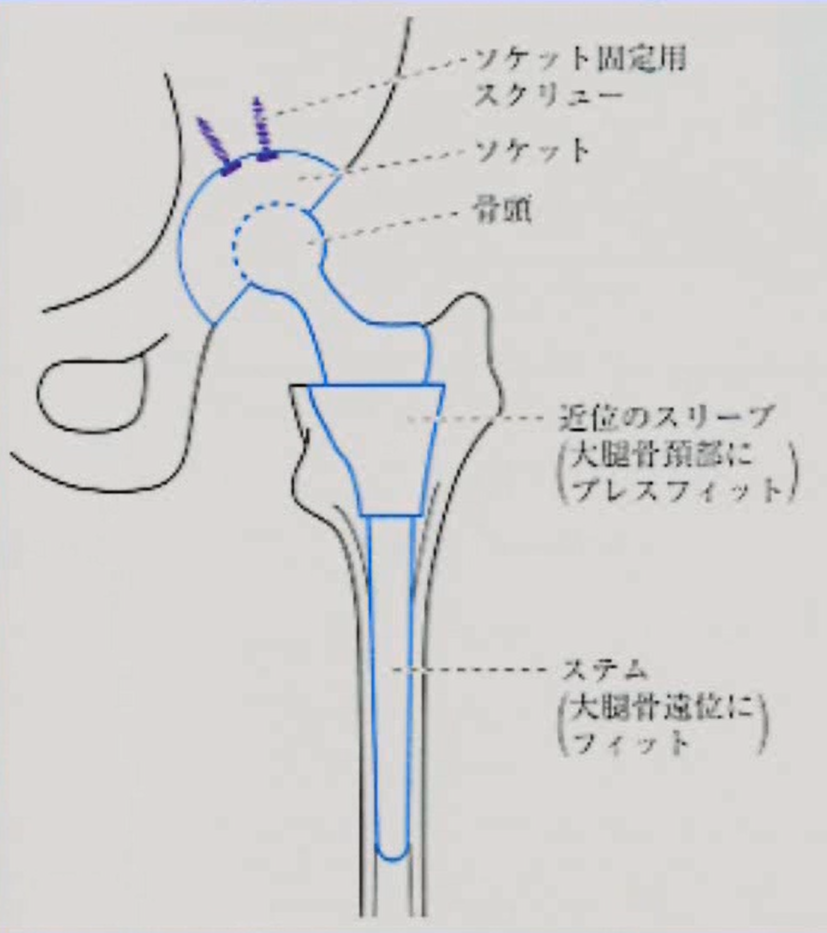 非セメント使用型