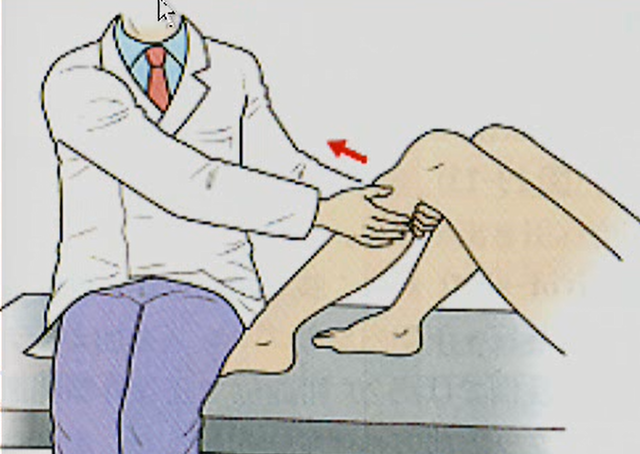 前十字靭帯(ＡＣＬ)損傷の病理