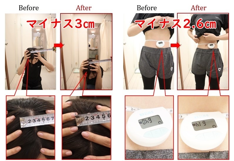 Before After 美容整体