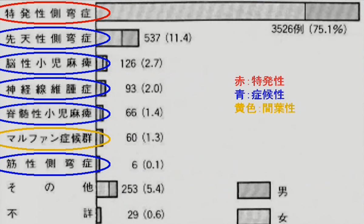 特発性側弯症