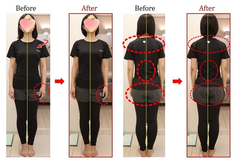 Before After 美容整体