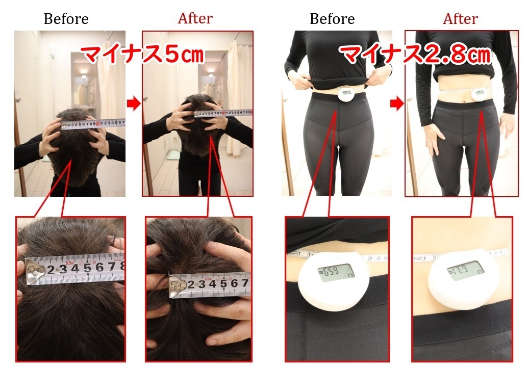 ビフォーアフター 美容整体