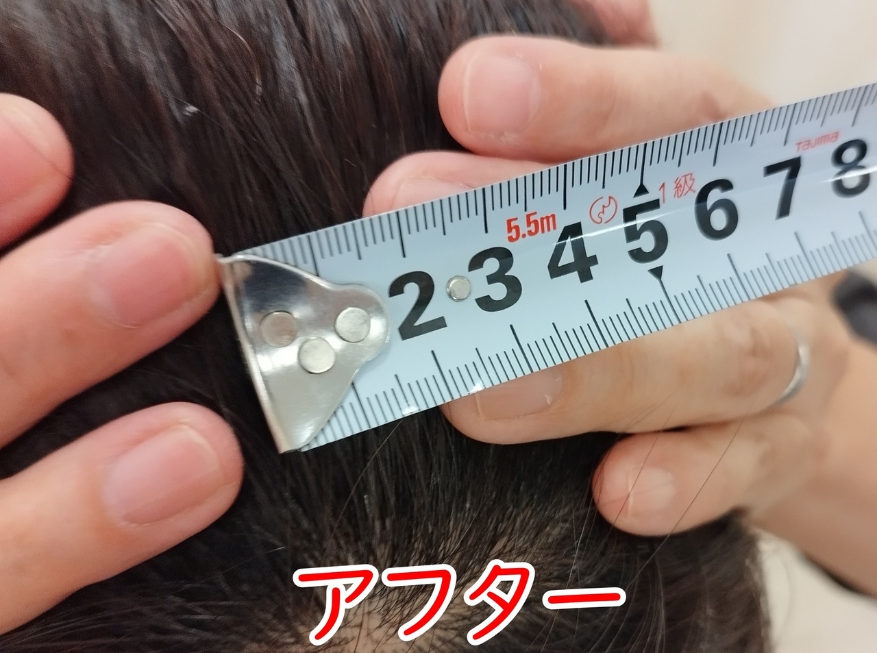 冨田勝RESET 品川区美容整体のアフター立位正面