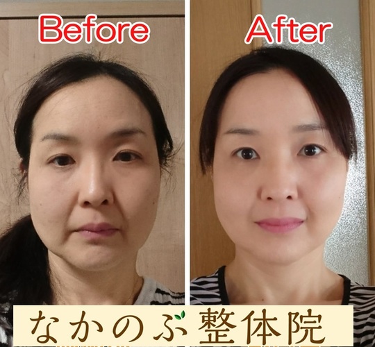 男性の小顔矯正も受付しています 品川初の小顔矯正 エンドリングフェイシャル 品川区の整体 産後の骨盤矯正と痛くない小顔矯正 が口コミで人気のなかのぶ整体院