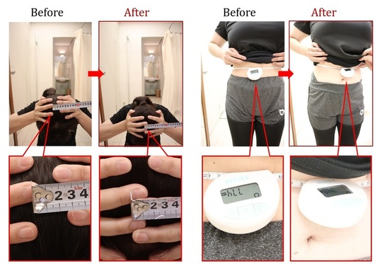 Before After 美容整体
