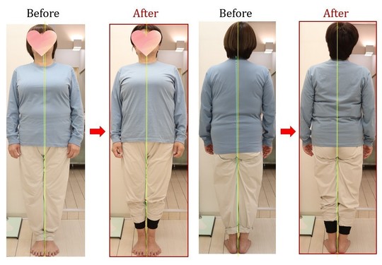 Before After 美容整体