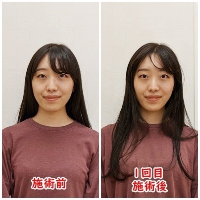 顔から姿勢を正す整顔術〜健美両立型のアプローチ〜 その他
