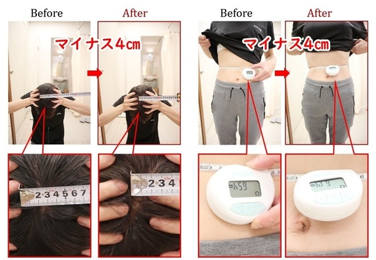 Before After 美容整体