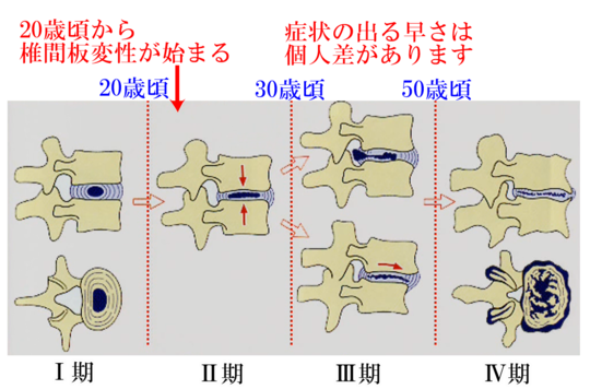 勃起不全のアーユルヴェーダの理由