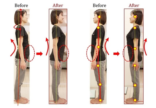 Before After 美容整体