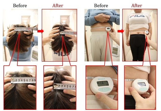 Before After 美容整体