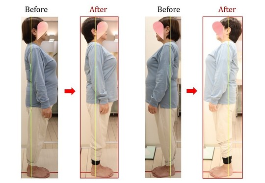 Before After 美容整体