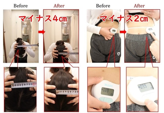 Before After 美容整体