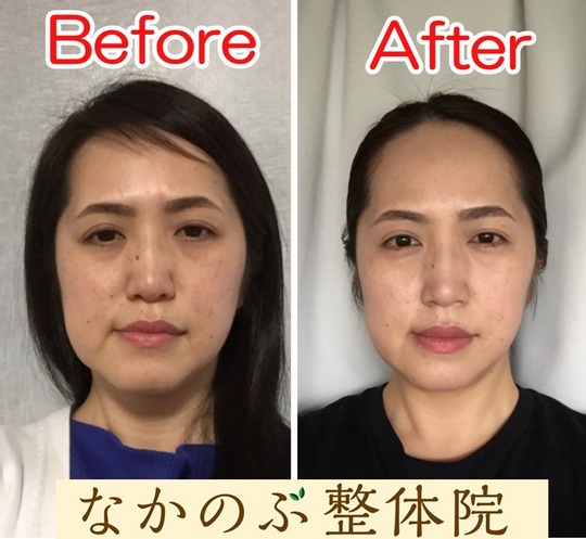 結婚式の前日に小顔矯正がおすすめな理由 ブライダル小顔矯正 品川区の整体 産後の骨盤矯正と痛くない小顔矯正が口コミで人気のなかのぶ整体院 結婚式の前日に小顔矯正がおすすめな理由 ブライダル小顔矯正 品川区の整体 産後の骨盤矯正と痛くない小顔矯正が口コミで人気のなかのぶ整体院