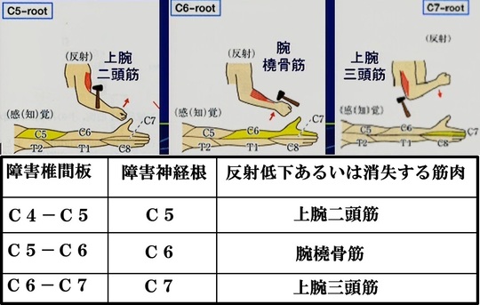 神経学的テスト(高位)