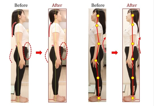 Before After 美容整体