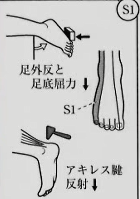 腰椎椎間板ヘルニアについて【整形外科学ブログ】