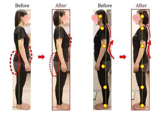 Before After 美容整体
