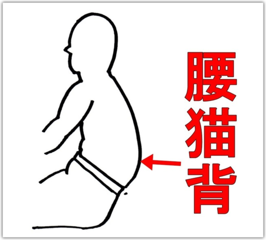 腰猫背