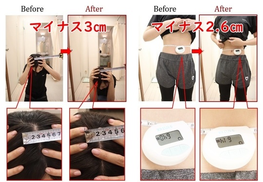 Before After 美容整体