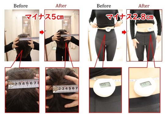 ビフォーアフター 美容整体